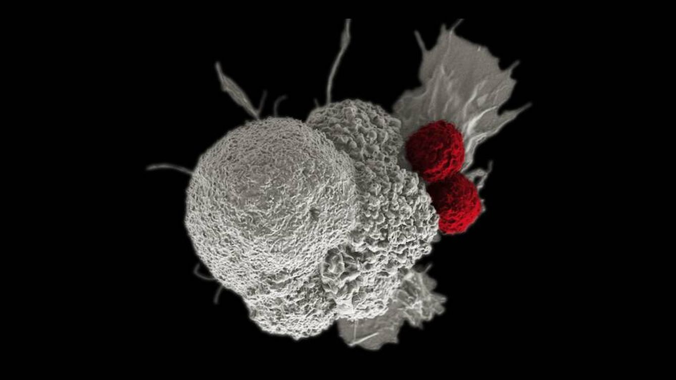 Foto: La proteína PLA2G7 impide la producción de linfocitos T, capaces de prevenir inflamaciones. (NIH)