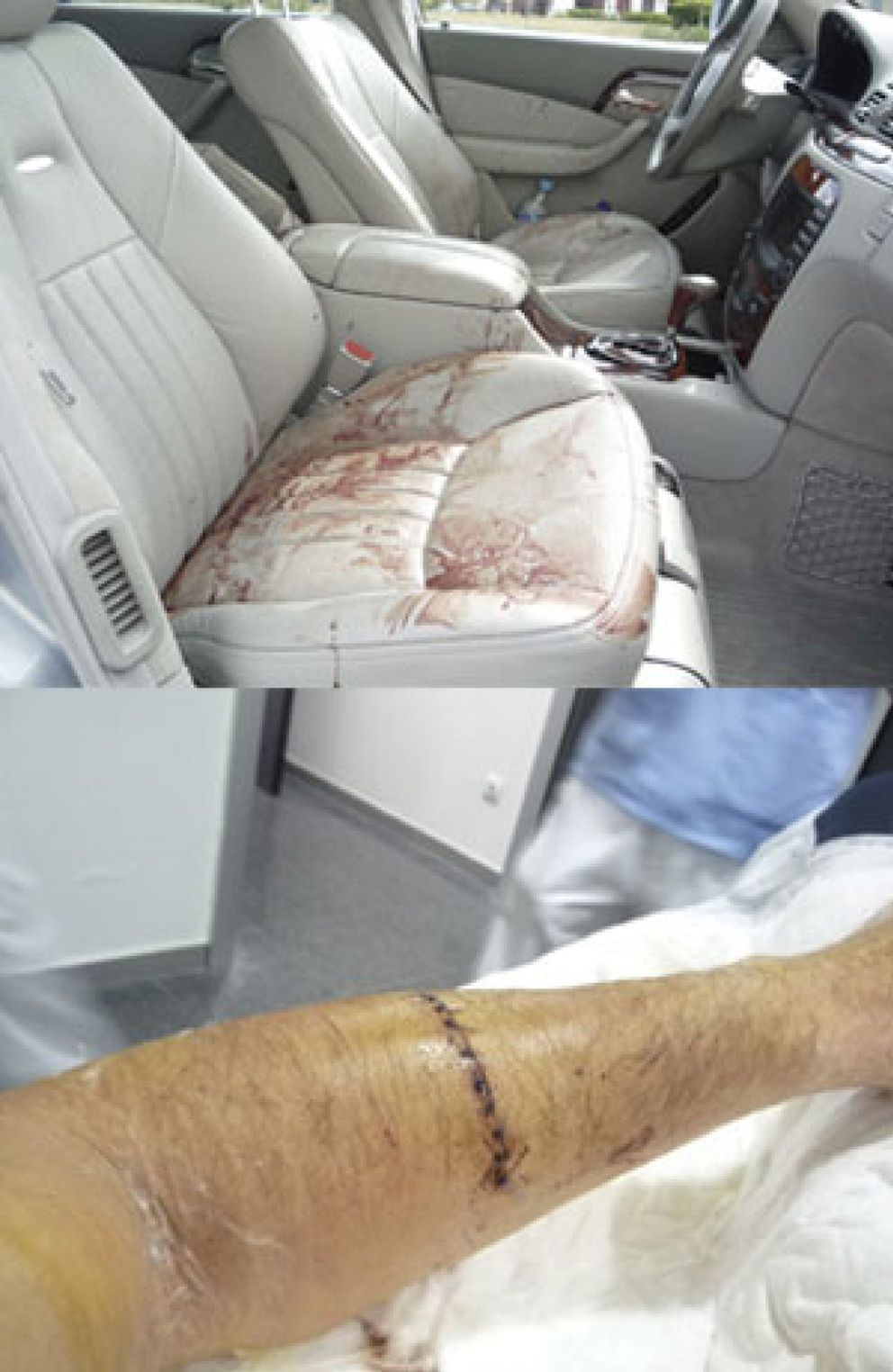 Foto: A machetazos contra el propietario de un Mercedes en Las Rozas a plena luz del día