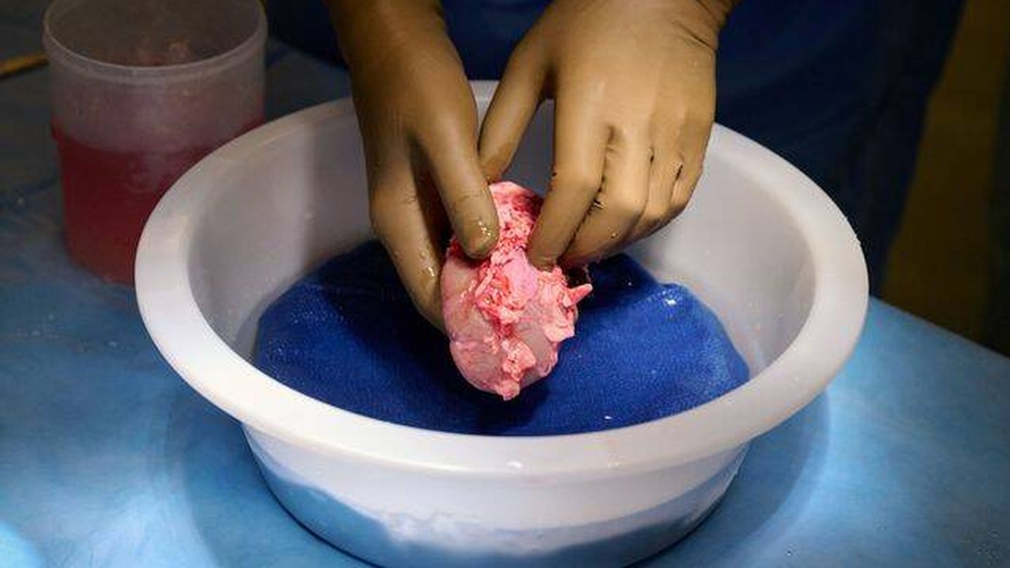 Un riñón de cerdo modificado genéticamente. (Reuters)