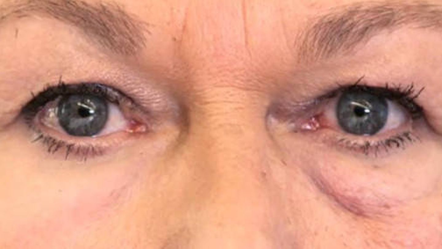 En pruebas con humanos se ha visto que reduce las bolsas de los ojos y también mejora la hidratación de la piel. / Olivo Labs, LLC