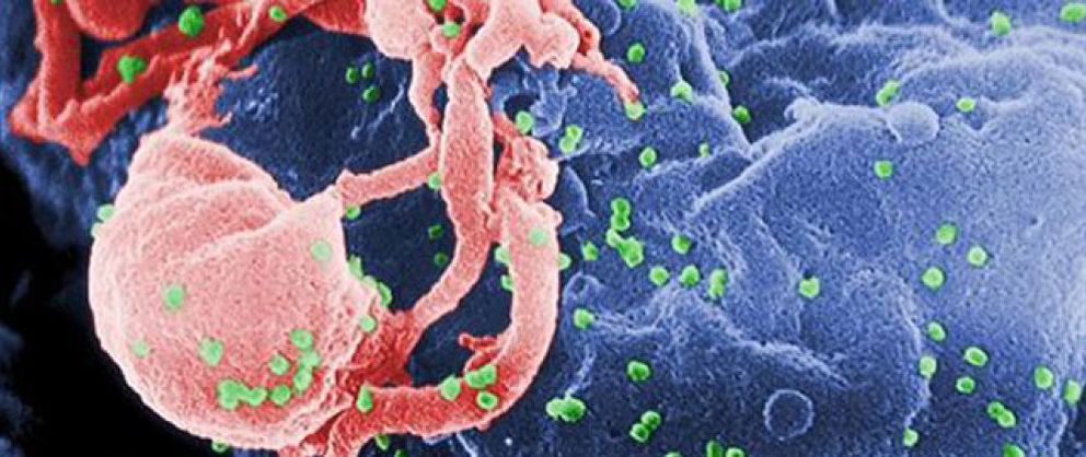 Foto: Hallan la clave de la virulencia del VIH y se abre el camino a más tratamientos