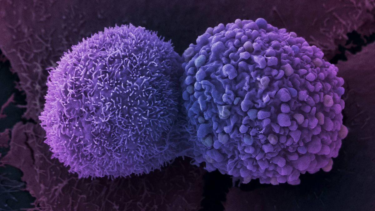 Crean el mayor 'mapa' genético del cáncer para detectarlo antes de que aparezca