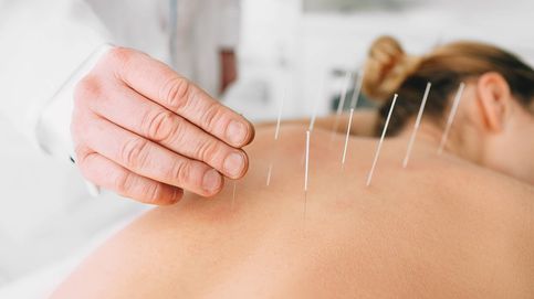 Cinco secretos que todavía no conoces de la acupuntura 