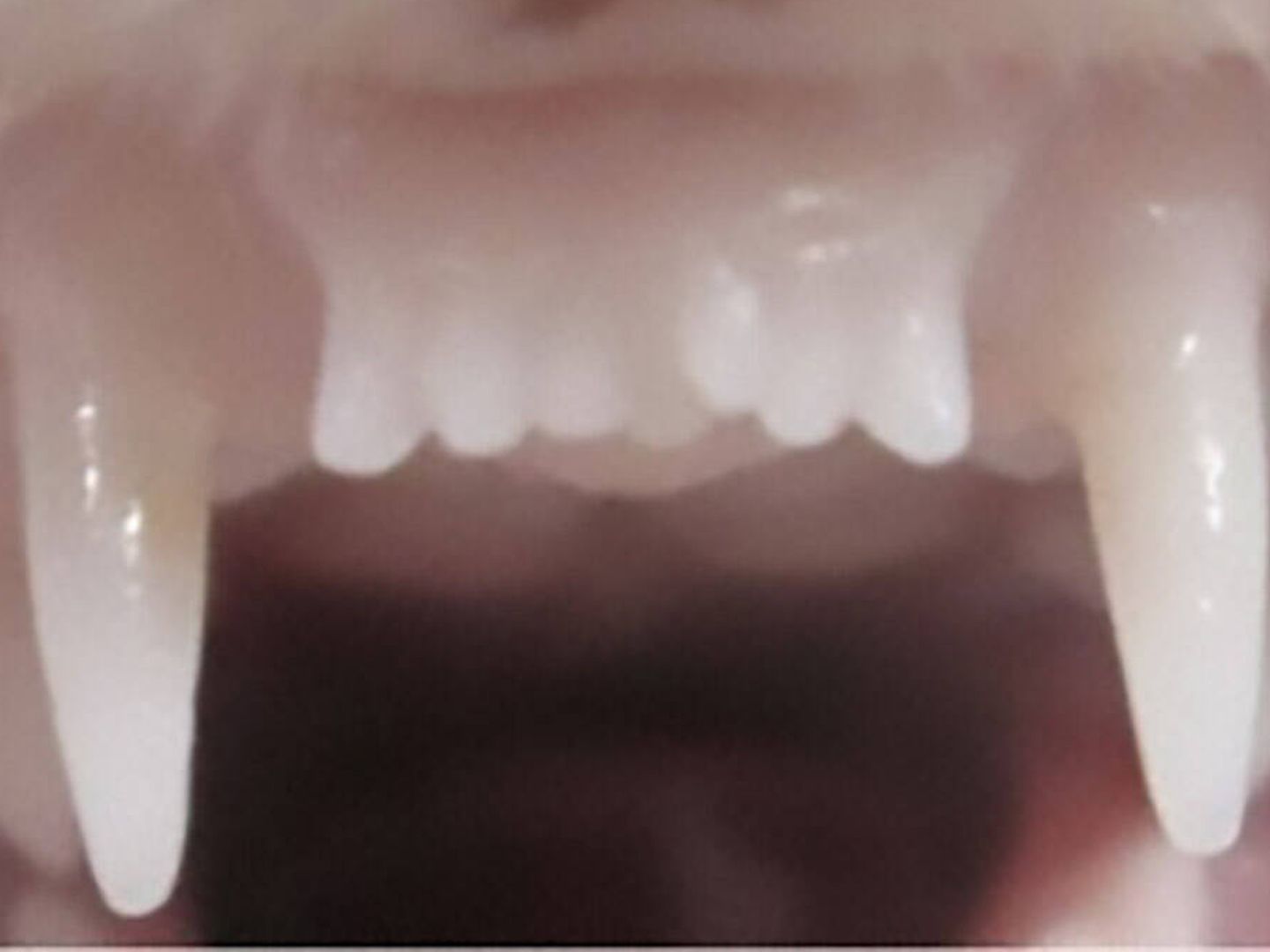 El tratamiento que hacer tener los dientes demostrado en un hurón. (Katsu Takahashi)