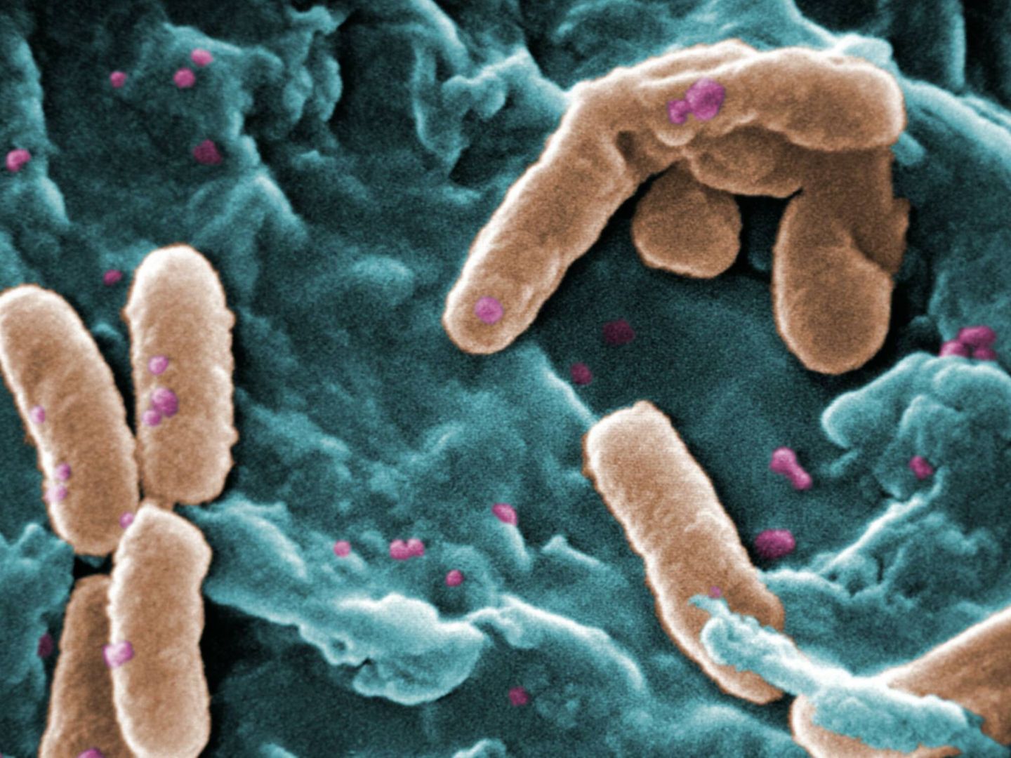 La bacteria P. aeruginosa también resiste el tratamiento con antibióticos. (Wikipedia)