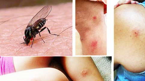 Del Ebro al Manzanares, la mosca negra coloniza España: Su mordisco es horrible