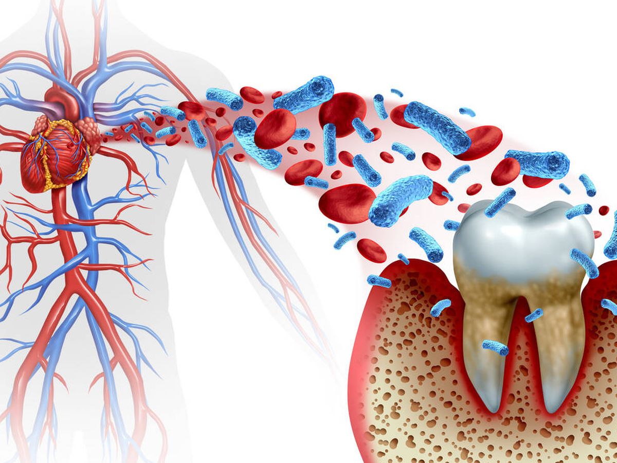 Foto: Las bacterias bucales viajan por el torrente sanguíneo pudiendo llegar al corazón. (iStock)