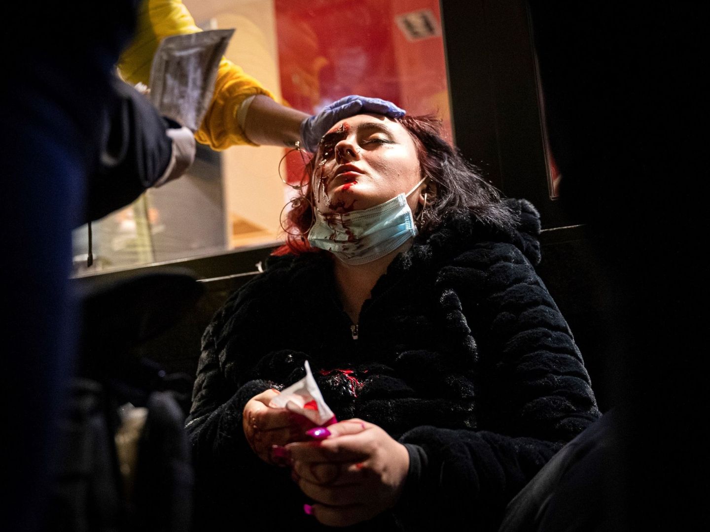 La joven que perdió un ojo en las protestas en Barcelona. (EFE)