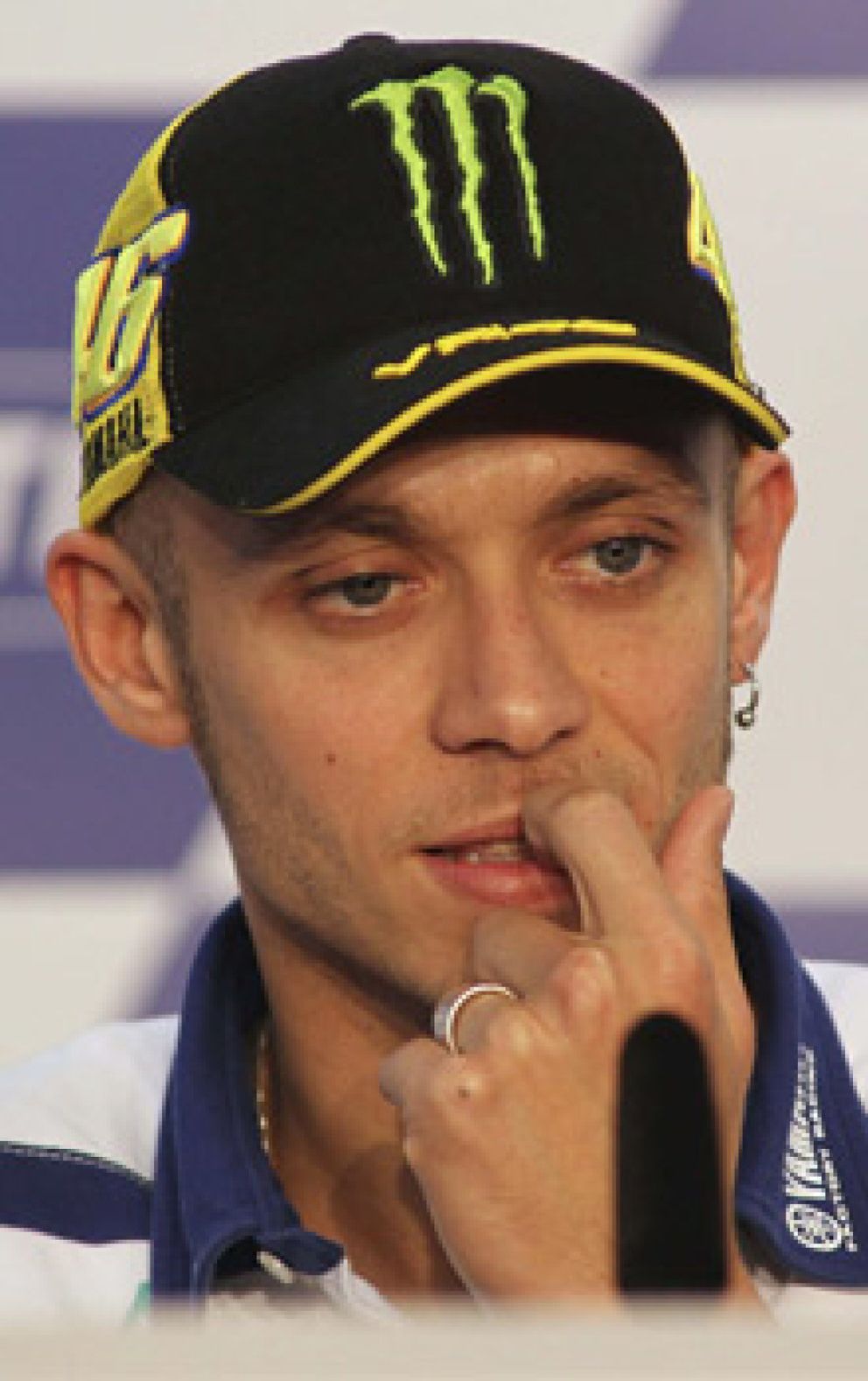 Foto: Rossi es intervenido por segunda vez y pasará una semana más en el hospital