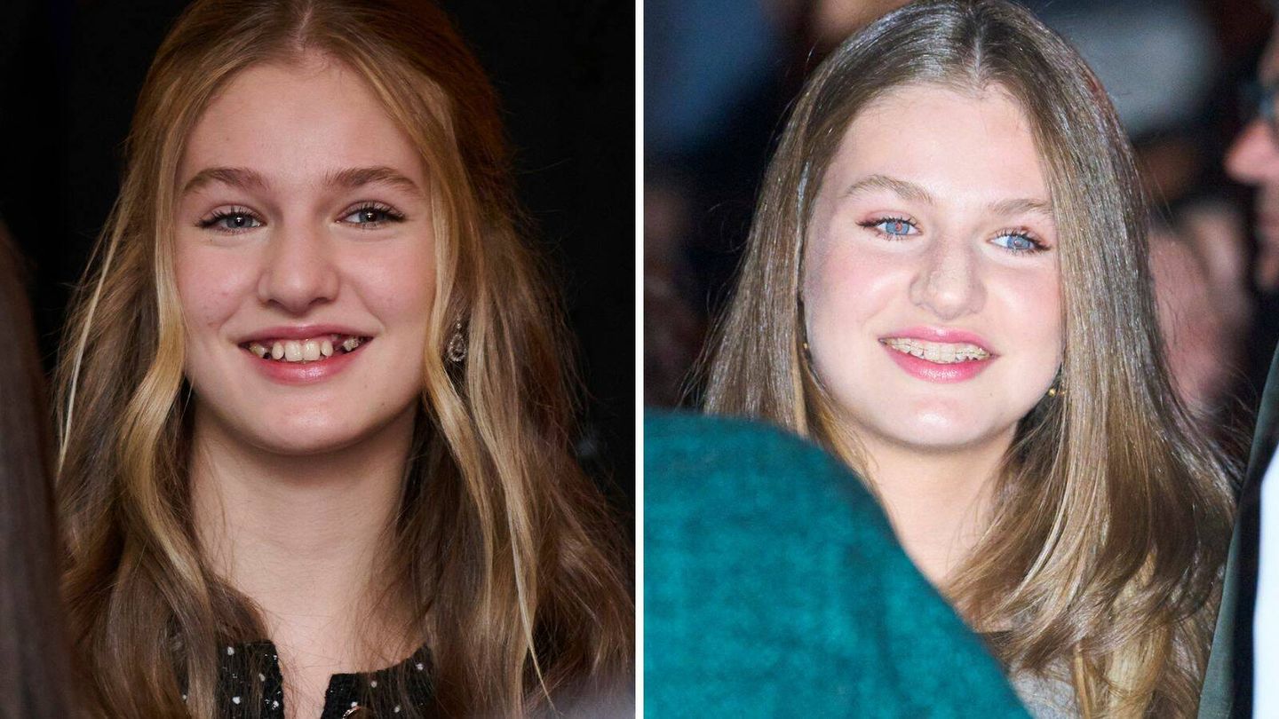 El antes y el después en la sonrisa de la princesa Leonor. (Getty/Carlos Álvarez/Limited Pictures)