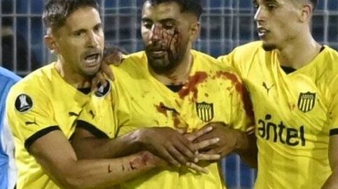 Noticia de Vallas, bengalas, pedradas y sangre sobre el campo: el vergonzoso episodio en la Libertadores