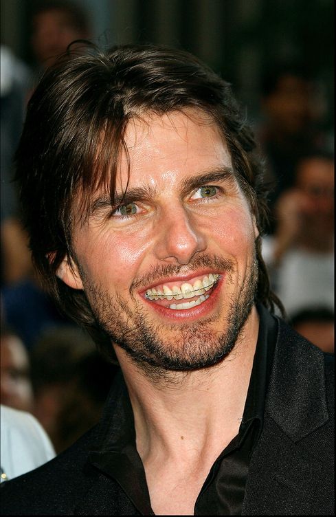 Tom Cruise es uno de los famosos que ha decidido corregir sus dientes