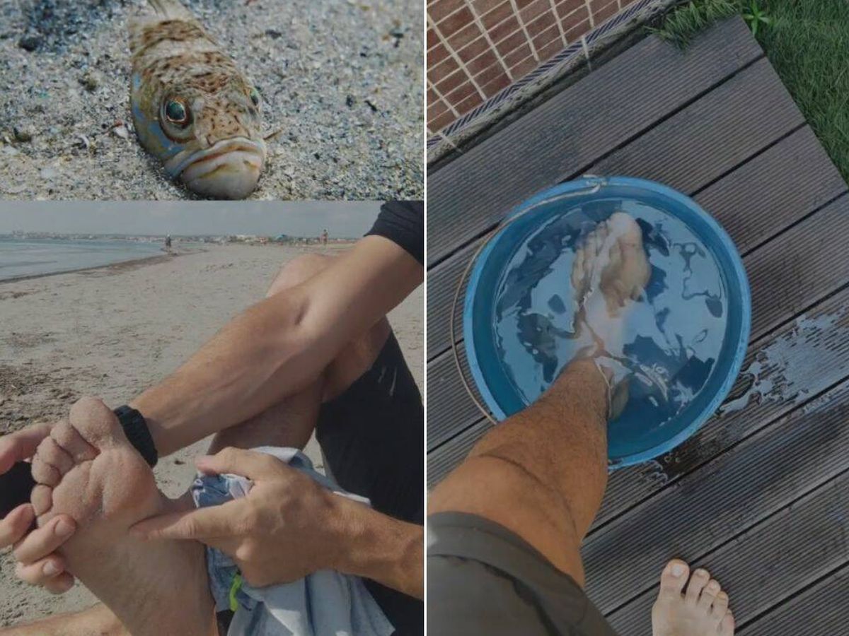Foto: Este sanitario te explica qué hacer si estás paseando por la playa y te pica un pez araña (TikTok/@miguelassal)