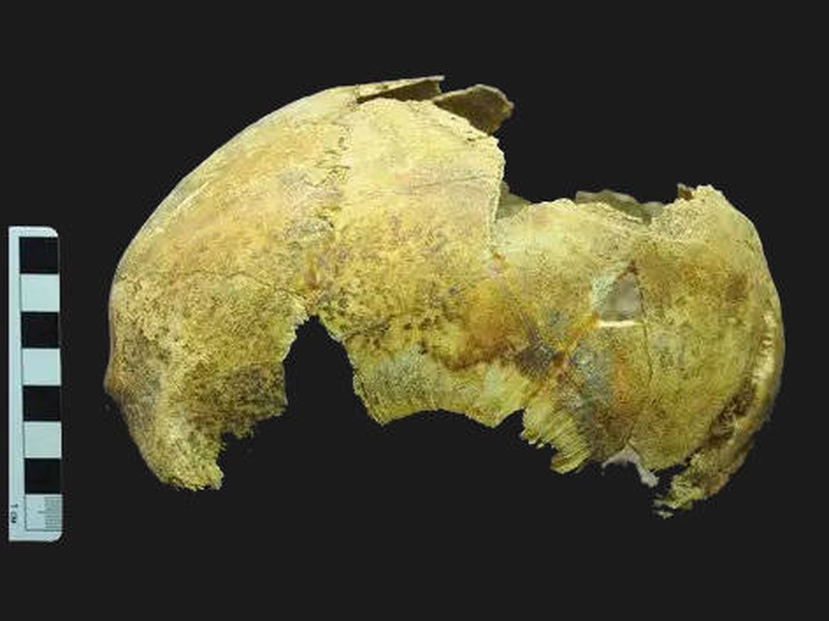 Foto: Restos del cráneo que fue sometido a una trepanación. Foto: Instituto de Arqueología de la Academia Rusa de Ciencias