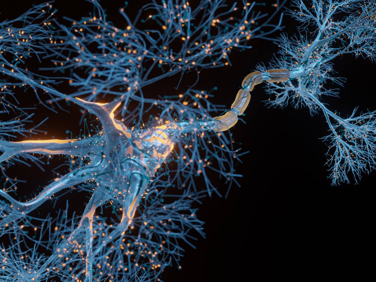 Foto: Vista microscópica de una neurona con sus axones y dendritas. (iStock)