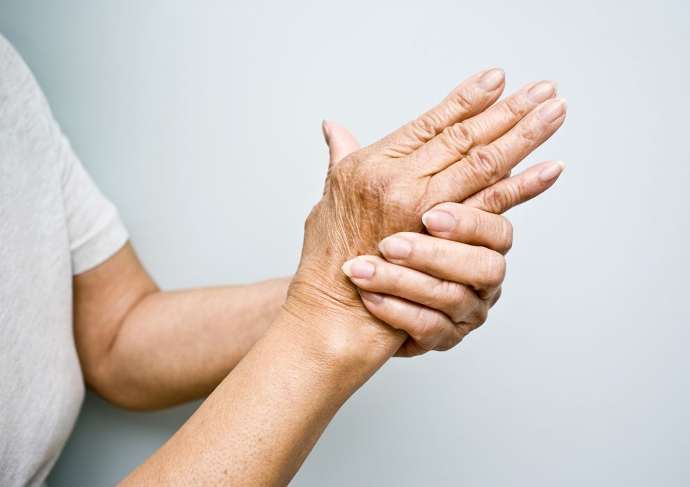 Foto: En España, la artrosis afecta al 16% de la población mayor de 20 años. (iStock)