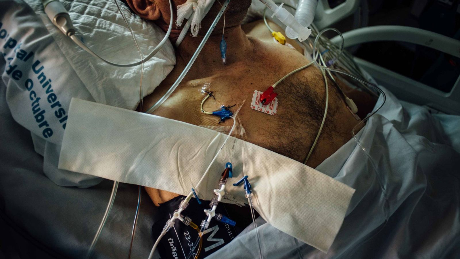 Foto: Un paciente en el Hospital Doce de Octubre de Madrid. (Pablo López Learte)