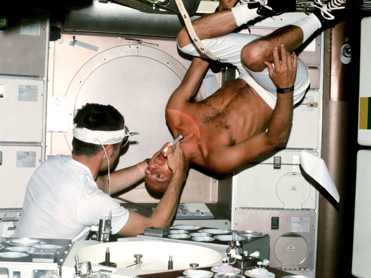 Foto: El astronauta de la NASA Charles "Pete" Conrad, comandante de la misión Skylab 2, sometiéndose a un examen dental realizado por el oficial médico Joseph Kerwin en las instalaciones de Skylab en 1973. (Wikimedia)