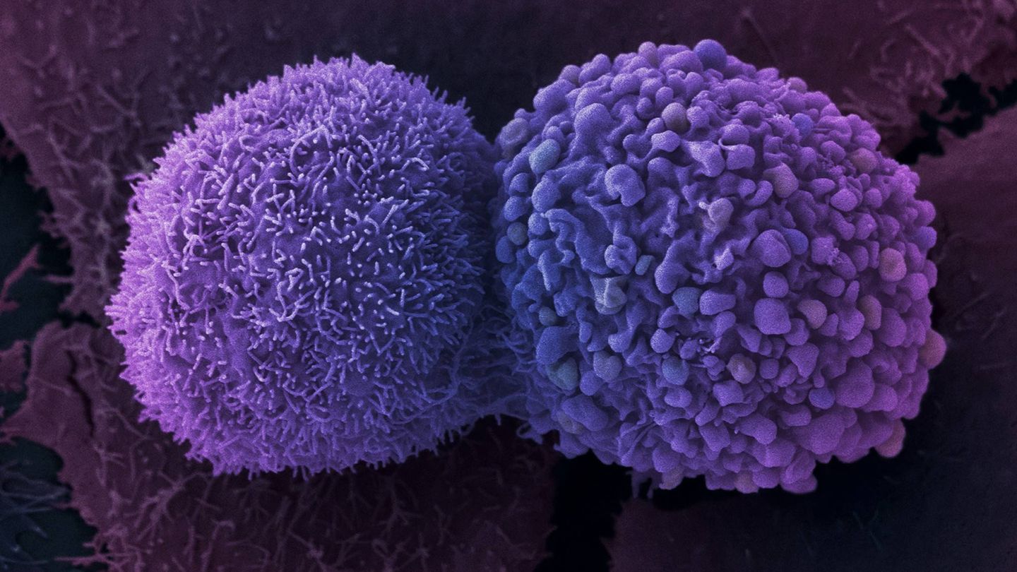 Células de cáncer de pulmón. (Anne Weston / Francis Crick Institute)