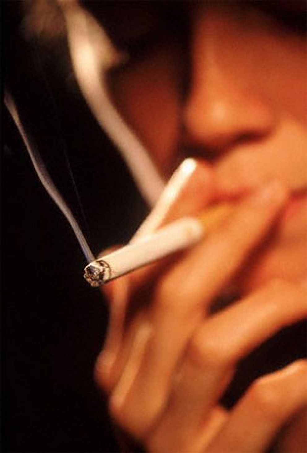 Foto: El tabaquismo pasivo eleva el riesgo de enfermedad arterial en las mujeres