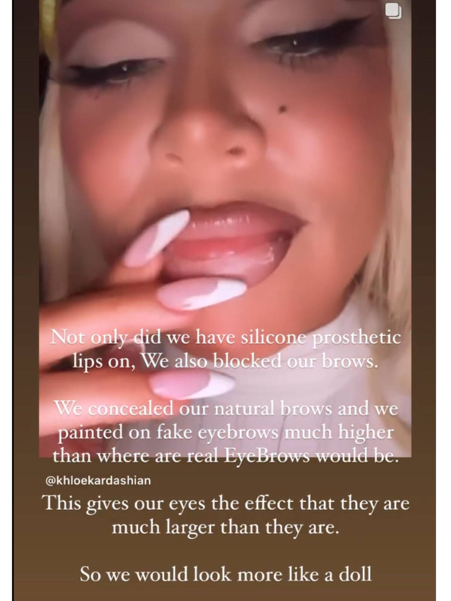 También en Instagram, Khloé Kardshian explicaba lo ocurrido con sus labios en Halloween. (Instagram/@kimkardashian)