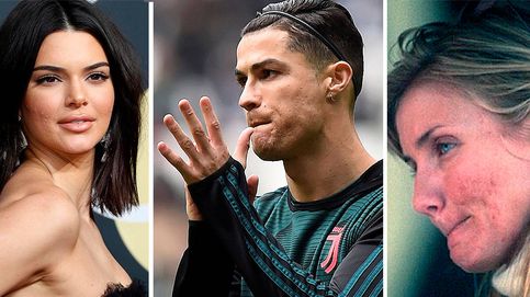 De Abascal a Ronaldo: por qué la ciencia aún no ha acabado con el acné... y sus cicatrices
