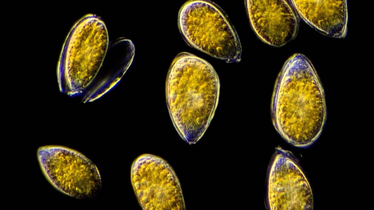 Un alga tóxica se expande por nuestras costas: puede provocar hasta fiebre