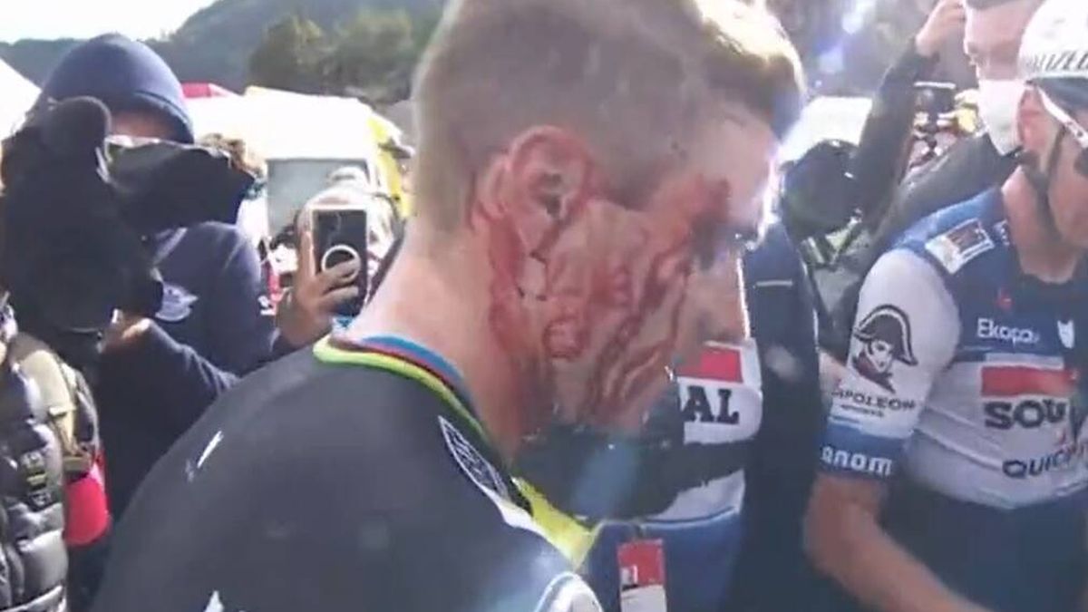 Evenepoel acaba con la cara ensangrentada y arremete contra la Vuelta ciclista a España: "Me está tocando las pelotas"