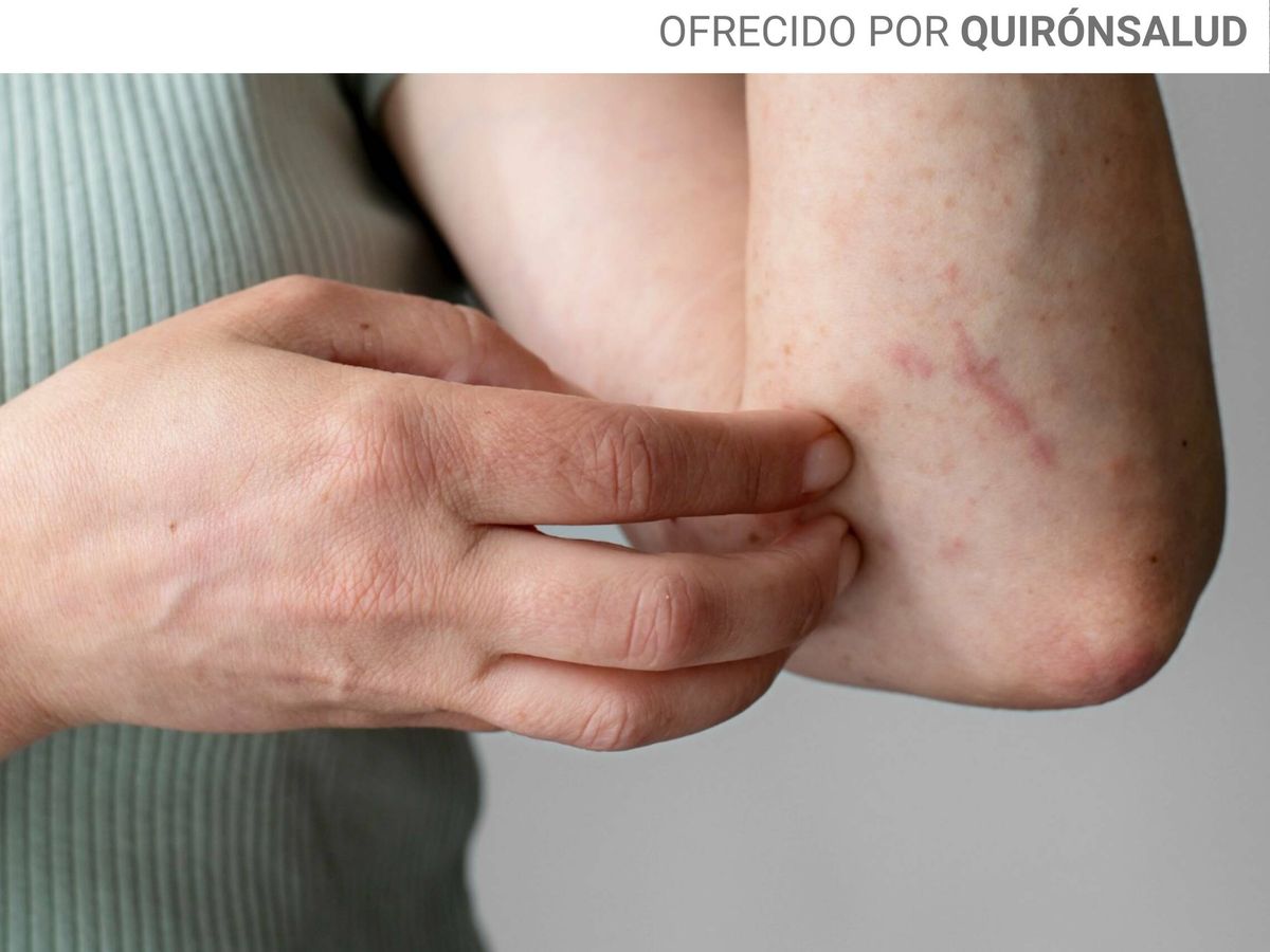 Jabones adecuados para niños con dermatitis atópica