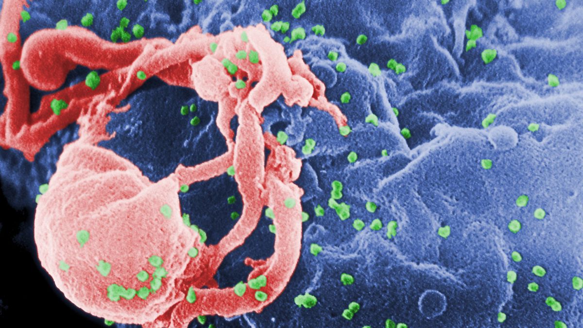 Continúa la remisión del VIH en un niño nacido con el virus del sida