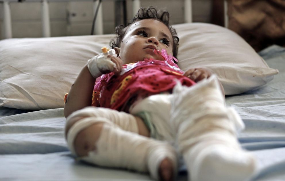 Una de los 2.877 niños heridos durante el conflicto. (EFE)