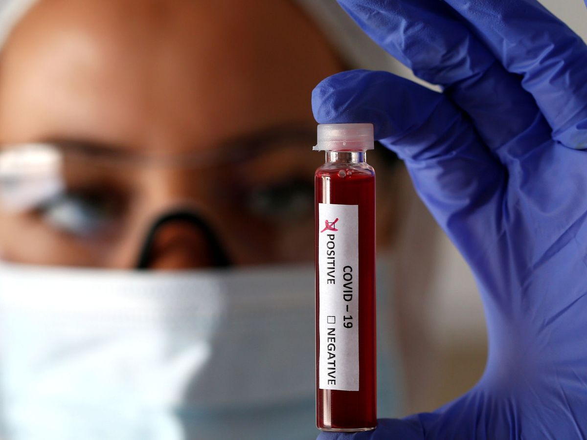 Foto: Simulación de muestra de sangre en un tubo de prueba de coronavirus. (Reuters)