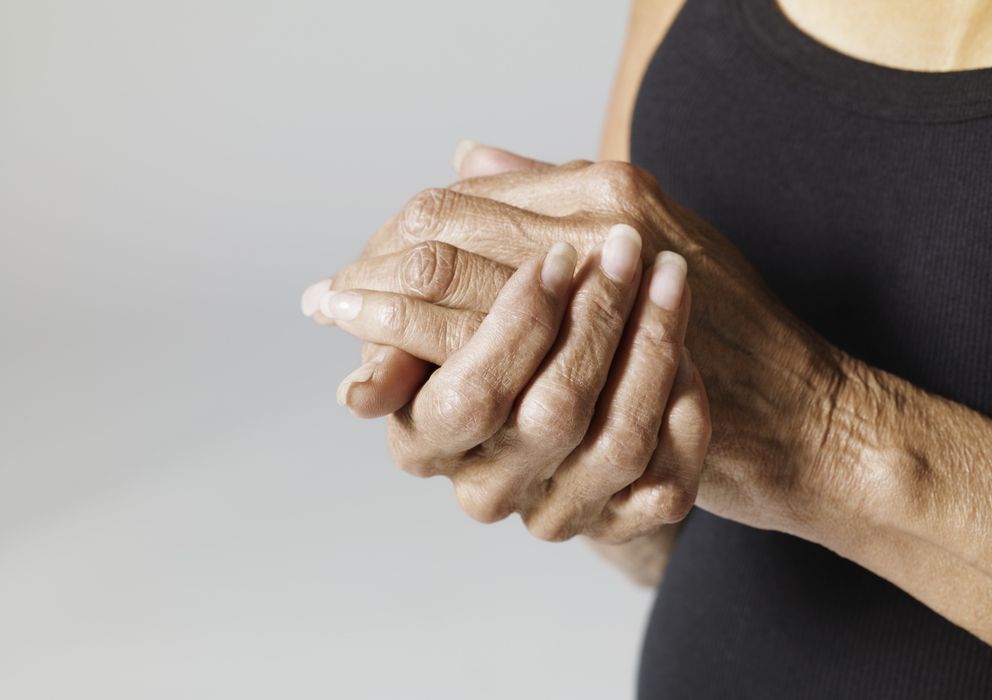 Foto: La osteoartritis es muy frecuente en las personas de avanzada edad. (Corbis)