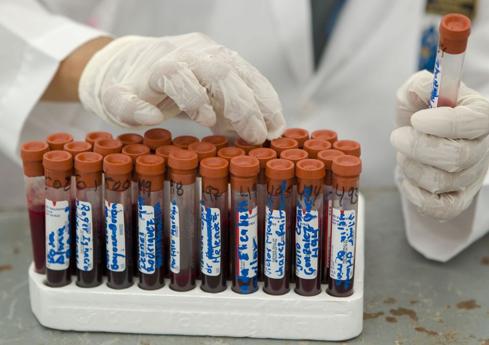 Foto: Varias muestras de sangre para chequear si contienen el virus del VIH.