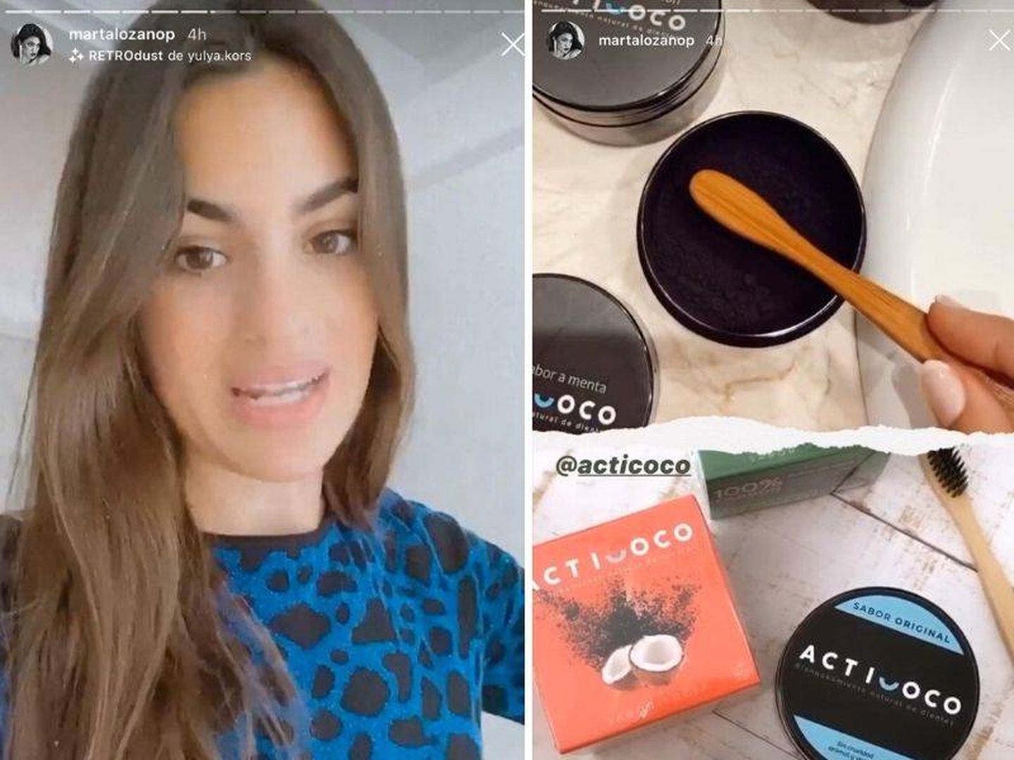 Marta Lozano blanquea sus dientes con este producto. (Instagram,@martalozano)