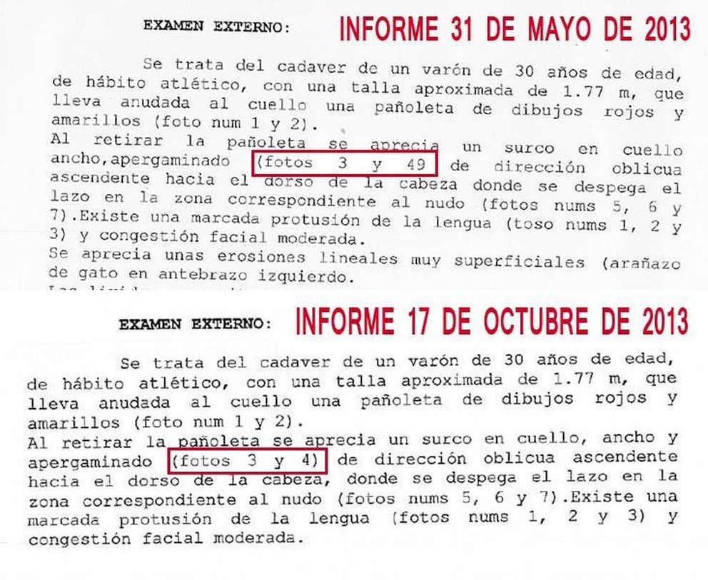 Comparación de los informes de la autopsia de Biondo (Vanitatis)