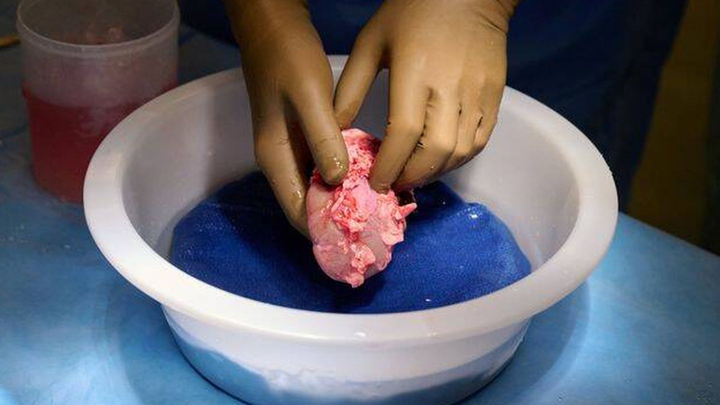 El riñón de cerdo modificado genéticamente. (Reuters)