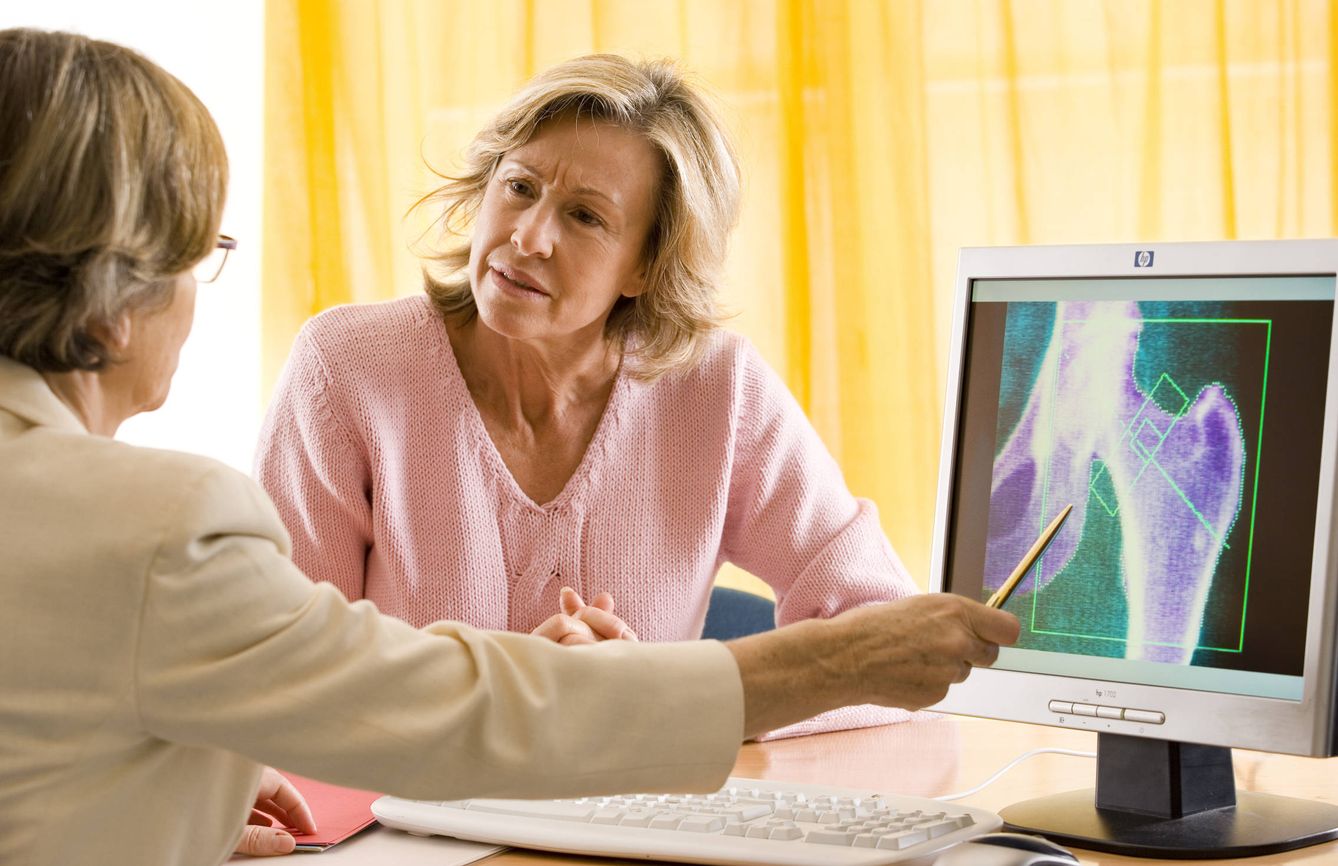 La osteoporosis es una enfermedad común entre las mujeres postmenopáusicas. (Corbis)