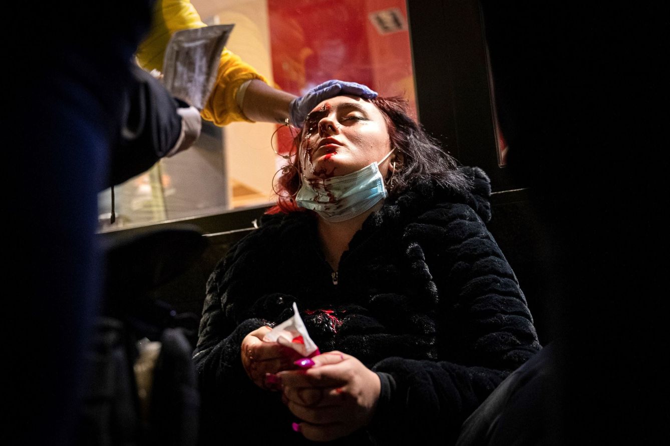 La joven que perdió un ojo en las protestas en Barcelona. (EFE)