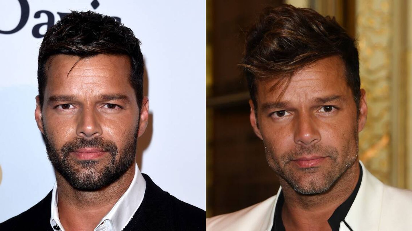 Detalle del posible relleno en el ángulo mandibular de Ricky Martin, comparando fotografías de 2015 y 2016. (Getty)