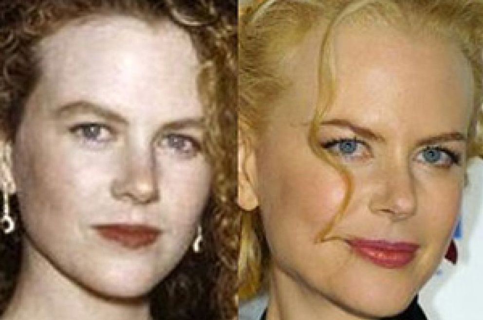 Foto: Belén Rueda, ¿la doble de botox de Nicole Kidman?