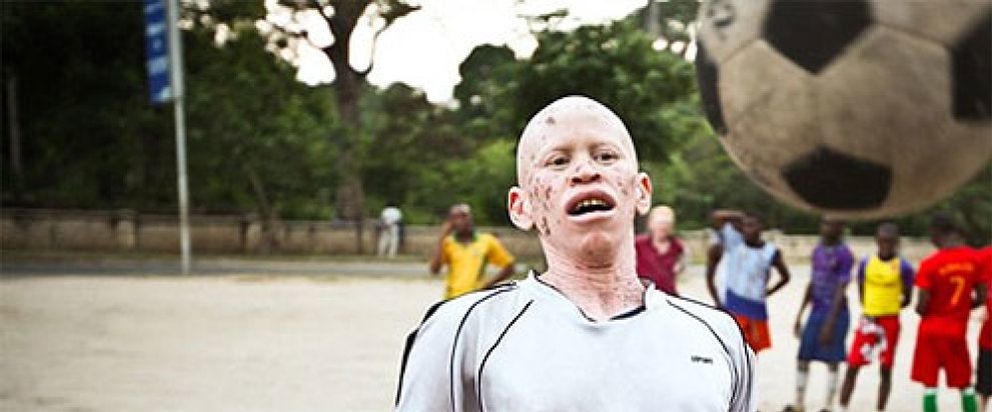 Foto: Albino United, el club de fútbol que humaniza a los 'demonios' de África