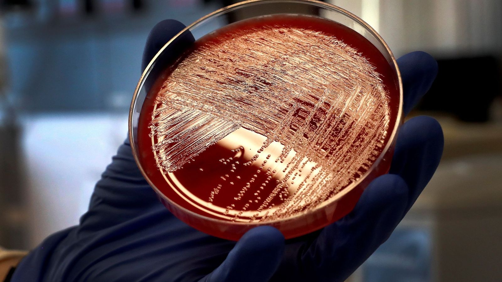 Foto: Una misma cepa de listeria en carne "la mechá" ha contaminado a 144 pacientes
