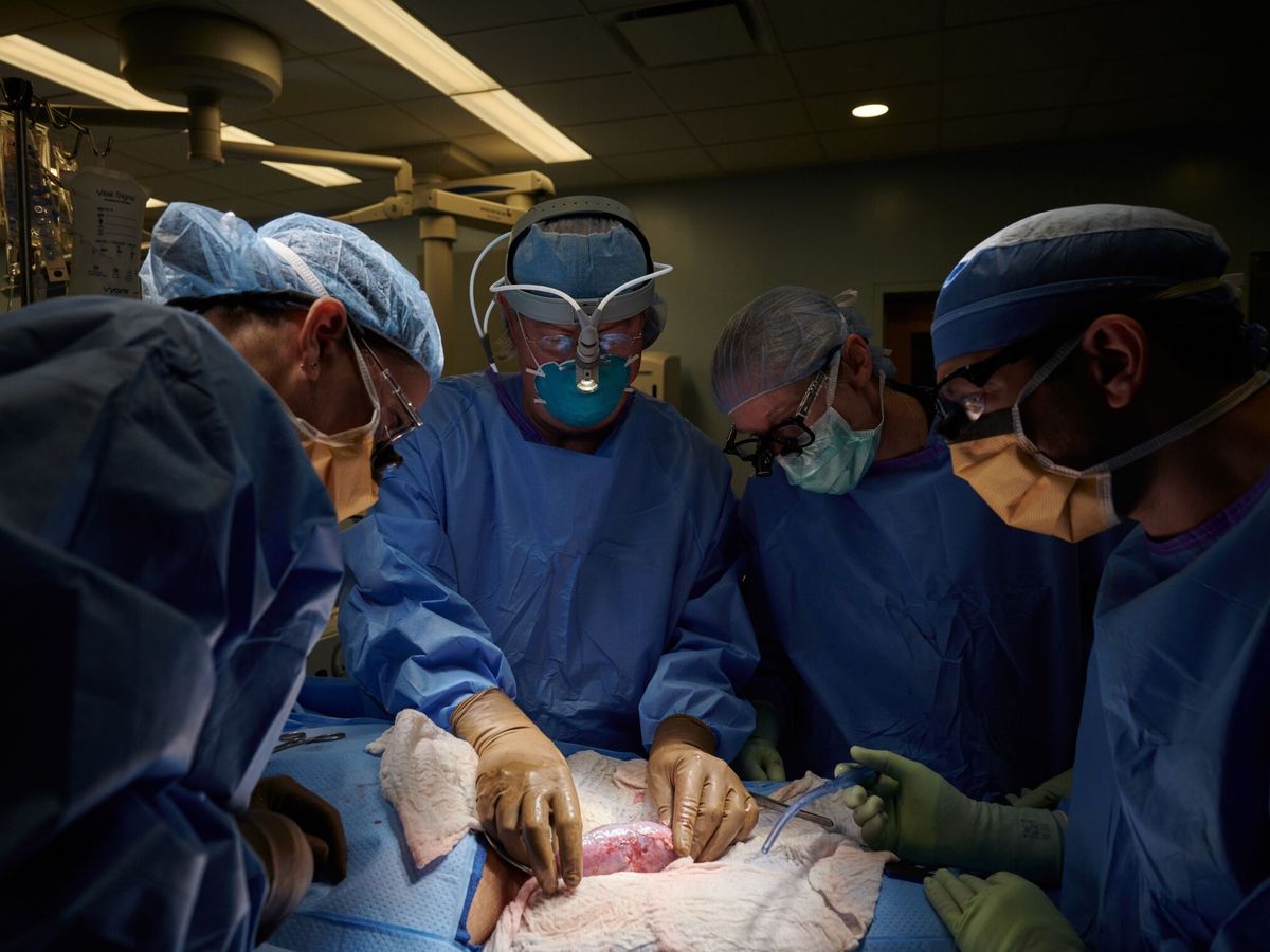 Foto: Imagen de archivo de un trasplante de riñón de cerdo no modificado en 2021. (EFE/NYU Langone Health/Joe Carrotta) 