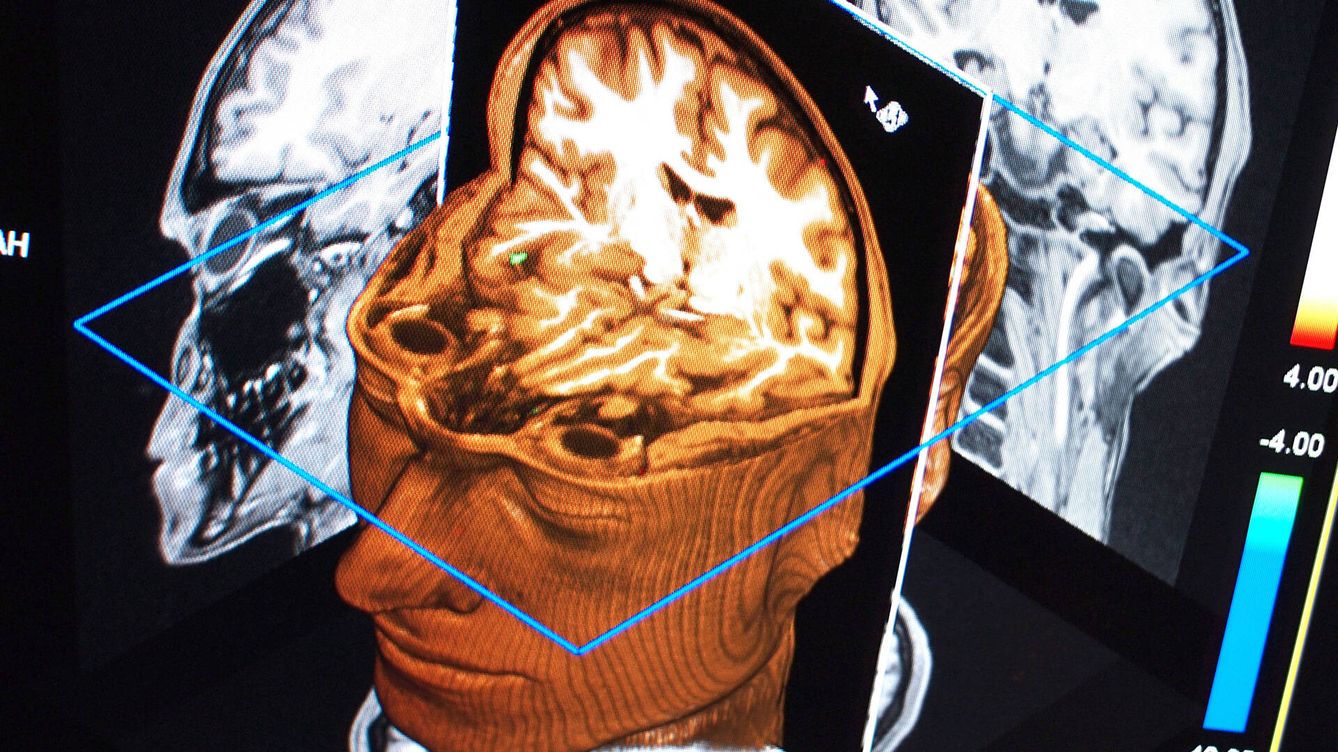 Foto: Pantalla de una máquina fMRI. (Martin Hieslmair/Ars Electronica/CC)
