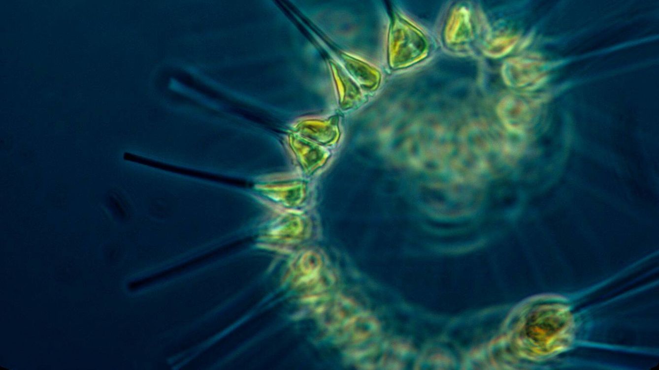 Foto: Imagen de un fitoplancton, que podría ser similar a las posible formas de vida en K2-18 b. (NOAA MESA Project)