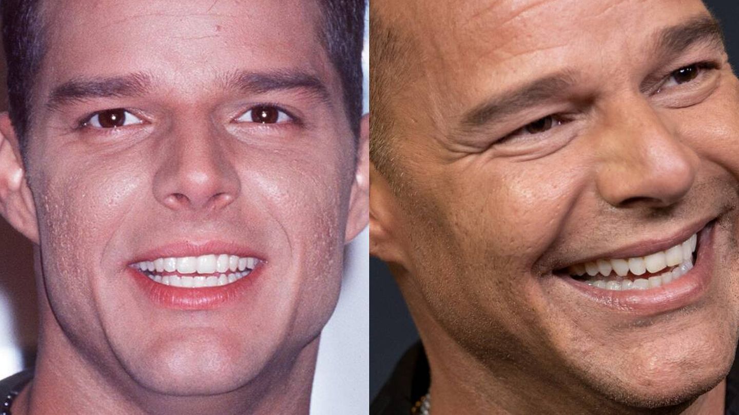 Detalle de la piel de Ricky Martin en 1999 y 2021. (Getty)