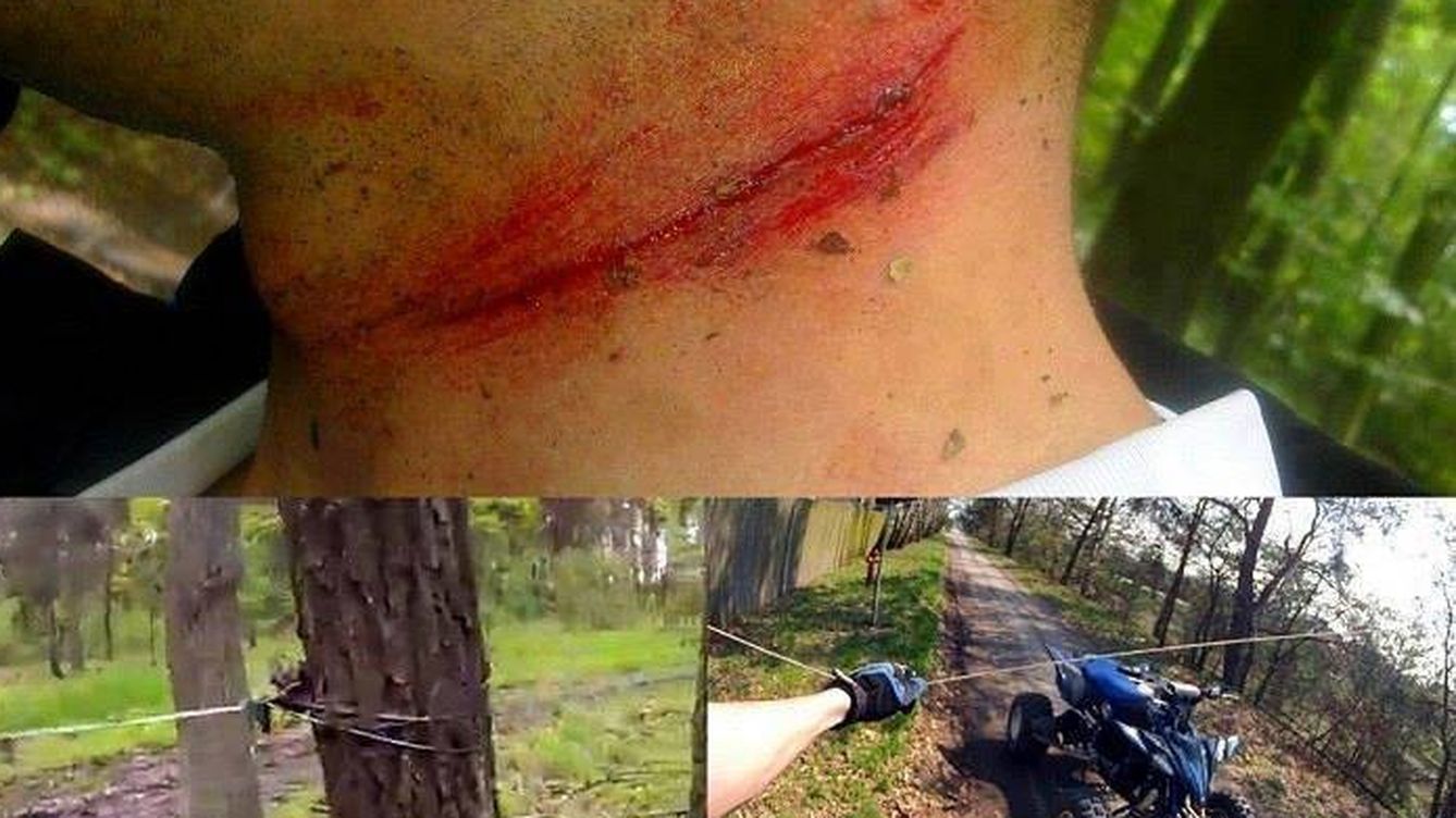 Así te pueden cortar el cuello cuando montas en bicicleta de montaña