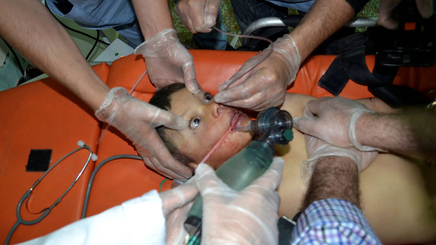 Un menor afectado por un supuesto ataque químico contra la ciudad siria de Telminnes. (Reuters) 