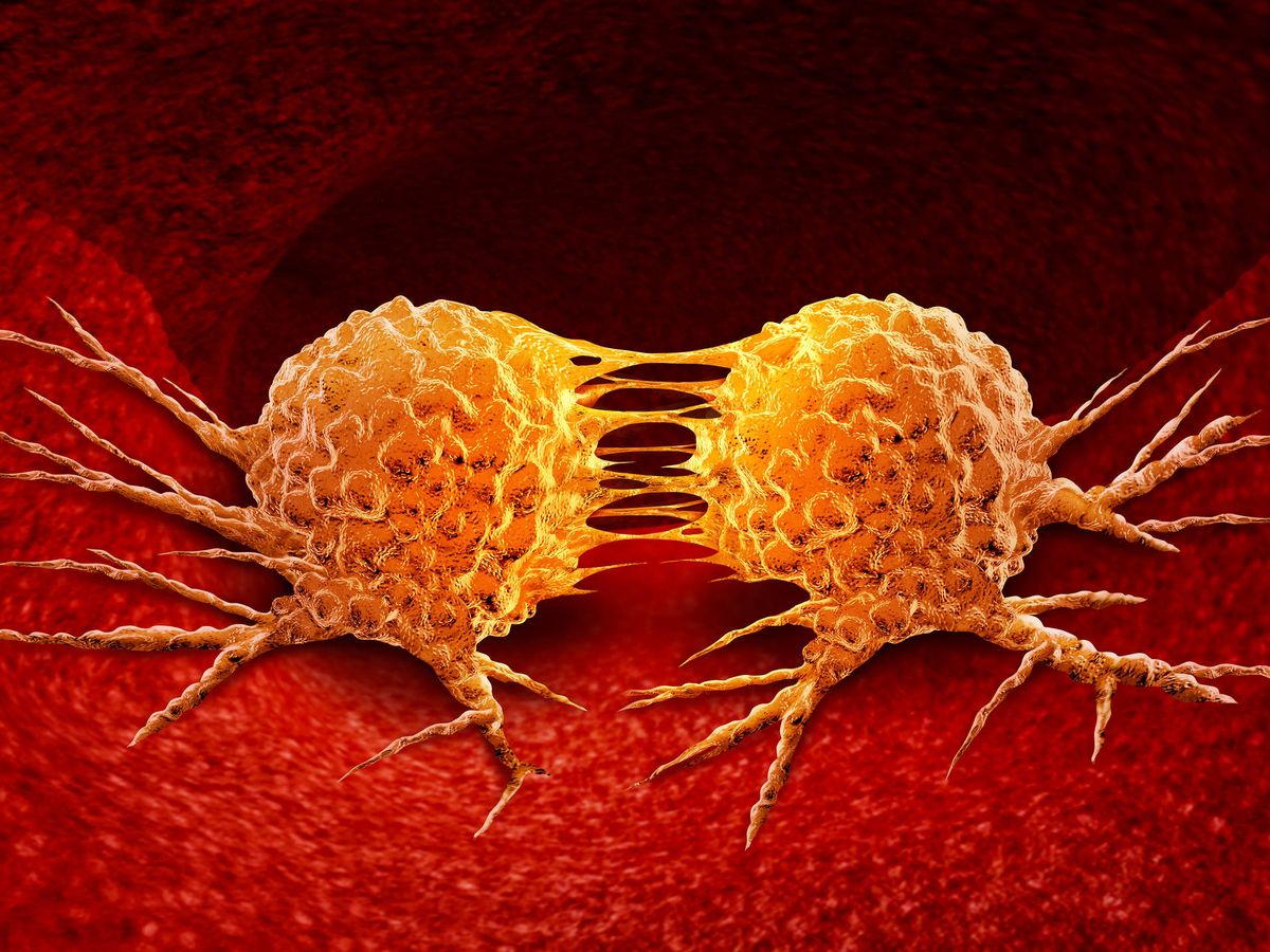 Foto: División de células cancerosas. (iStock)